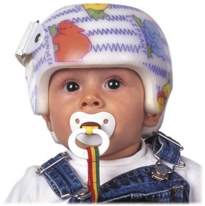 tratamiento para la plagiocefalia