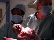 Etapas parto: Expulsión