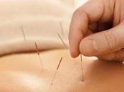 ¿Cómo puede acupuntura ayudar cuando trata concebir?