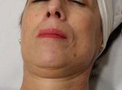 tratamiento anubismed salud belleza