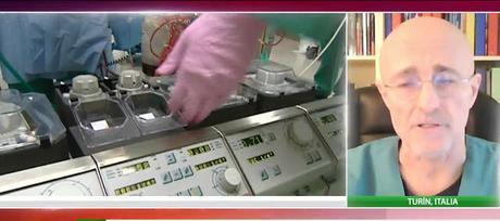 En 2017 se realizara el primer trasplante de cabeza en humanos