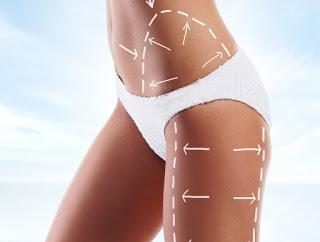 liposuccion revolucionaria