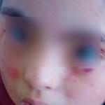 Escuela Rafaela Arganiz le entrega golpeada a su hija