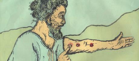 Día Mundial de la Lepra: enfermedad bíblica que sigue de actualidad
