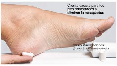 Cómo hacer crema casera para los pies secos o maltratados