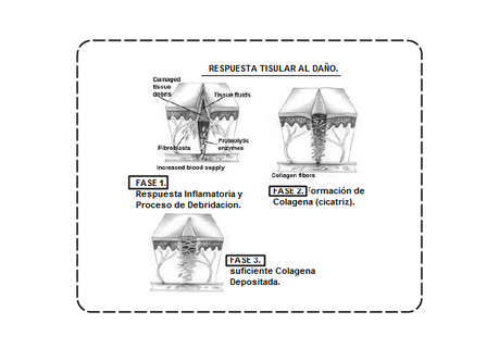 Respuesta DañoTisular.