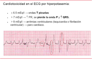Los minerales clave en la enfermedad renal crónica (por Tatiana Diaz Castro) Los minerales clave en la enfermedad renal crónica (por Tatiana Diaz Castro)