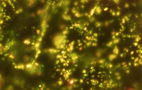 Nanoesferas contra el cancer (2)