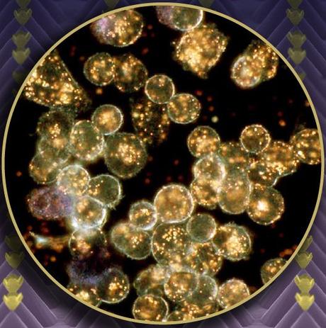 Nanoesferas contra el cancer (2)