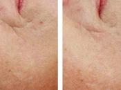 Continuamos tratamiento anubismed +salud+belleza