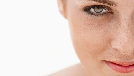 10 maravillosos remedios caseros para manchas en la cara