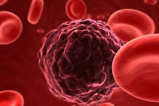 cancer en sangre