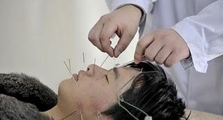 La acupuntura tiene sus riesgos