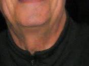 SOLIDARIDAD. SILO. Santiago 1991