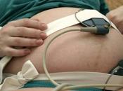 Electrocardiograma fetal través piel madre