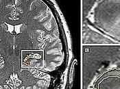 estrés 'desordena' nuestros recuerdos