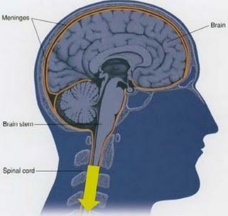 Todo sobre la epidural para parto sin dolor Todo sobre la epidural para parto sin dolor