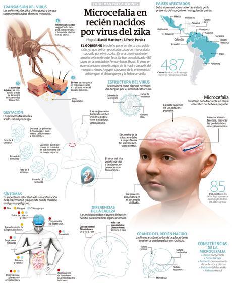 MICROCEFALIA DE ADULTOS