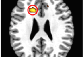 Así cambia nuestro cerebro con la meditación