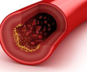 ¿Qué infusión se puede tomar en cada caso? ¿Qué infusión se puede tomar en cada caso?