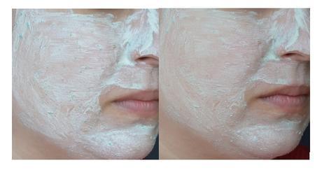 La nueva gama de BE+ para pieles grasas con tendencia acnéica – un efectivo y completo ritual anti-acné