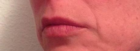 marketing participativo, marketing, blog de belleza, solo yo, blog solo yo, pre-hyaluron, alisa y rellena, antiarrugas, inneov,