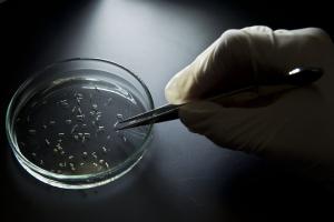 Aedes aegypti mosquitos are seen in containers at a lab of the Institute of Biomedical Sciences of the Sao Paulo University, on January 8, 2016 in Sao Paulo, Brazil. Researchers at the Pasteur Institute in Dakar, Senegal are in Brazil to train local researchers to combat the Zika virus epidemic. / AFP / NELSON ALMEIDA (Photo credit should read NELSON ALMEIDA/AFP/Getty Images)