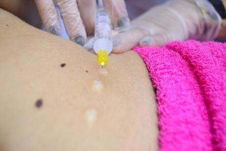 nice-body-mesoterapia-clínica-dorsia