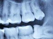 Dolor muelas: ¿qué podemos hacer?