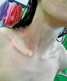 Futbolistas del Femenino Cáceres relatan agresiones salvajes en el campo del Naranjo (Córdoba)