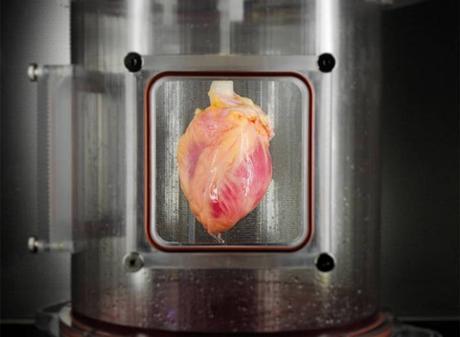 Fabrican corazón humano funcional a base de células de piel Fabrican corazón humano funcional a base de células de piel