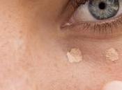 temidas ojeras: ¿qué detrás?