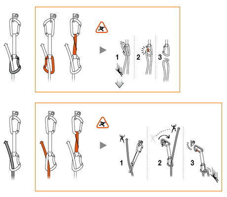 Colocación de la cinta exprés