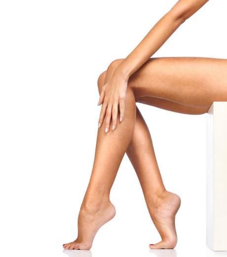 ¡Socorro, varices en las piernas! ¿Hay tratamiento para eliminarlas? varices en las piernas