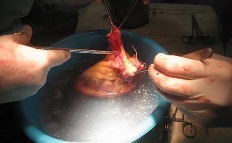 Dentro del Mercado Negro