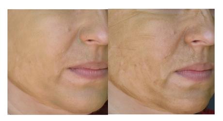 Un rostro “10” con la Mascarilla Purificante de NATURAL CAROL