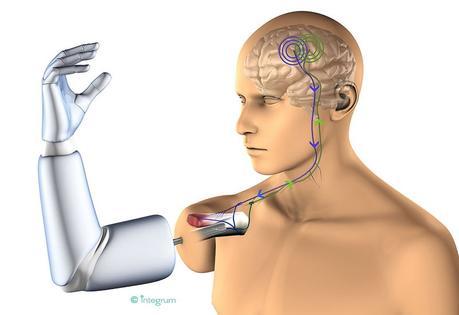 Prótesis con conexión directa a hueso, nervios y músculos