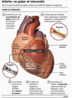 SALUD: Estudios sobre alimentación vegetariana y enfermedad cardiovascular