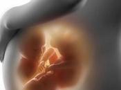 ¿Qué necesita saber sobre contracciones Braxton Hicks?