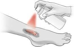 Medicamento en aerosol para heridas crónicas y pie diabético