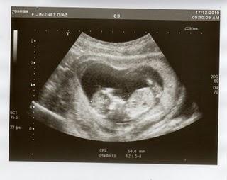 Entre lo que se va y lo que viene