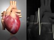 Conducta tipo cardiopatía coronaria
