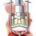 Valvuloplastia Aortica Transcateter