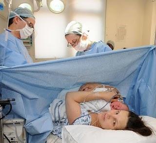 La Cesárea Asistida: Cuando la madre recibe en sus manos a su bebé