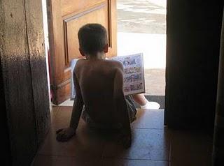 El desafío de la psoriasis infantil