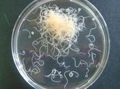 ¿Hay anisakis tras cáncer gastrointestinal?