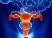 Cáncer ovario: Causas, factores riesgo, síntomas, tratamiento prevención