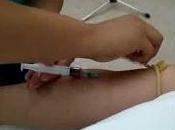 Desarrollan Primer Torniquete Farmacologico