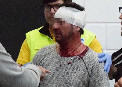 Sangre en el fútbol base