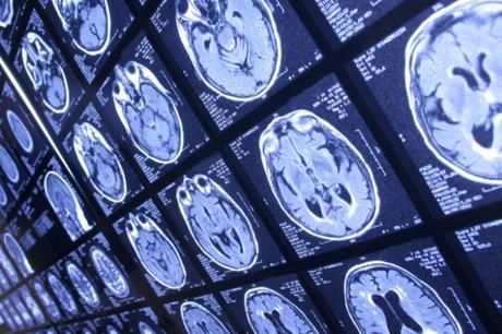 Neurociencia: evitar el desengaño – Investigación y Ciencia